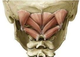 Deep neck muscles holding the atlamte in the wrong position